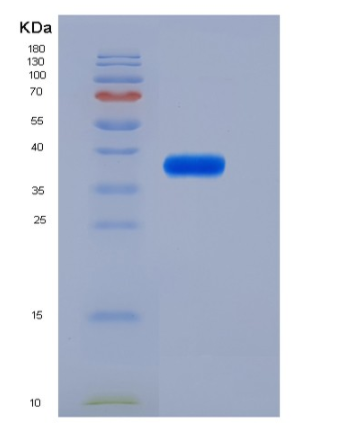 Recombinant Mouse IL6RA / CD126 Protein (His tag)