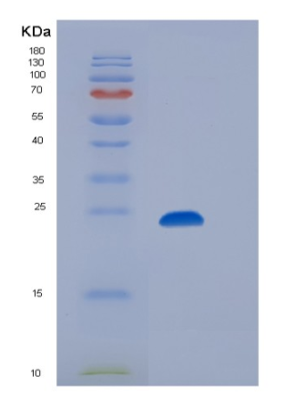 Recombinant Human CD32b / FCGR2B Protein (His & AVI tag)