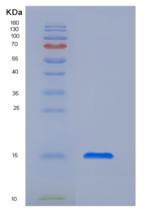 Recombinant Human CTLA4 / CD152 Protein (His tag)