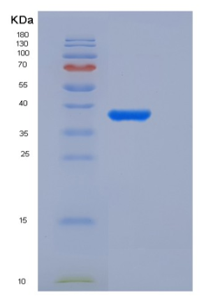Recombinant Human ACYP2 Protein (GST Tag)