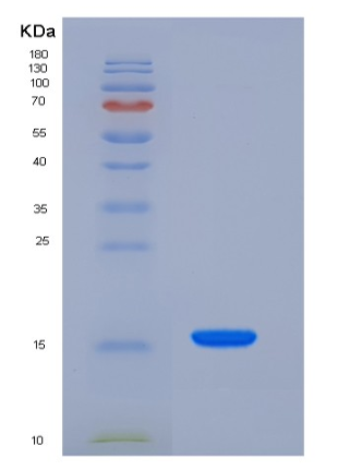 Recombinant Rat Niemann-Pick disease type C2 / NPC2 Protein (His Tag)
