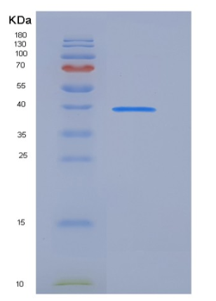 Recombinant Human sFRP4 Protein (His tag)