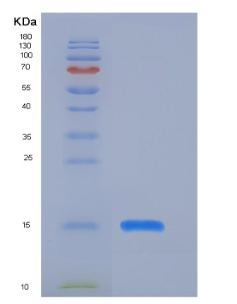 Recombinant Human SAP Protein (His Tag)