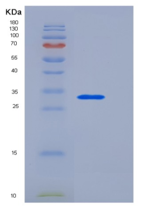 Recombinant Human Beta-amyloid 39 / Beta-APP39 Protein (aa 672-710, His & GST tag)
