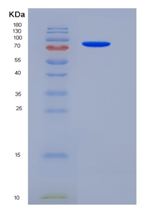 Recombinant Rat EphA3 Protein (Fc tag)