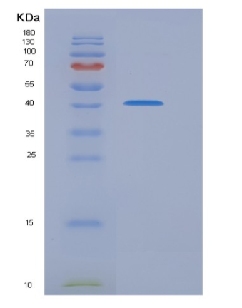 Recombinant Human ITCH / AIP4 Protein (aa 526-903)