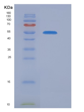 Recombinant Mouse CNDP2 Protein (His Tag)