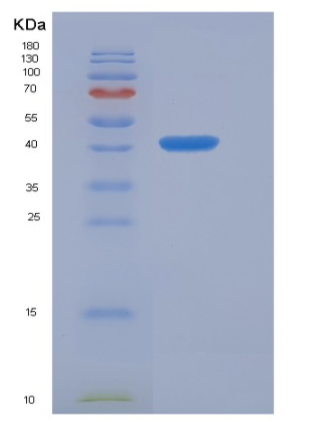 Recombinant Human Frizzled-6 / FZD6 Protein (Fc tag)