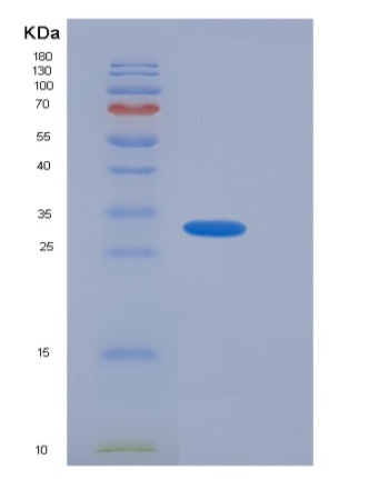 Recombinant Human ACBD6 Protein (His tag)