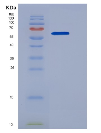 Recombinant Human LSAMP Protein (Fc tag)