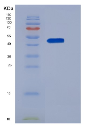 Recombinant Human SerpinI1 / Neuroserpin Protein (His tag)