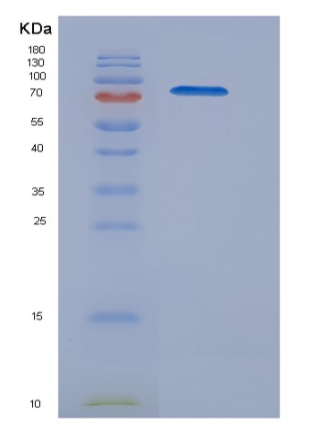 Recombinant Mouse BCAM Protein (Fc tag)