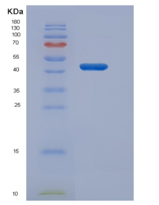 Recombinant Human Gastric lipase / LIPF Protein (His tag)