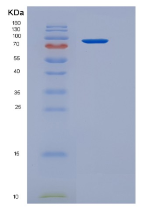 Recombinant Human BBOX1 / Gamma-BBH Protein (His & GST tag)
