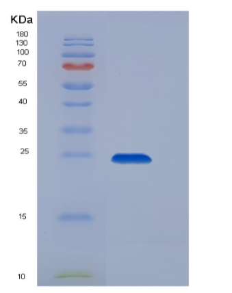 Recombinant Rat Layilin / LAYN Protein (His tag)