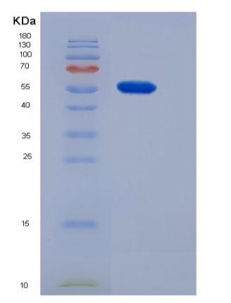 Recombinant Mouse CNDP1 Protein (His tag)