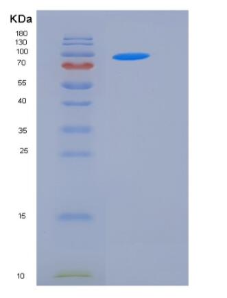 Recombinant Human STXBP3 / UNC-18C Protein (His & GST tag)