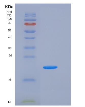 Recombinant Human H1F0 / Histone H1 Protein (His tag)