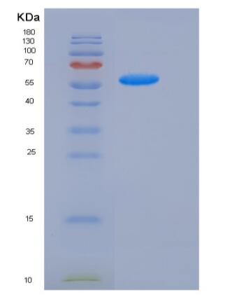 Recombinant Mouse Follistatin / FST (FS288) Protein (Fc tag)