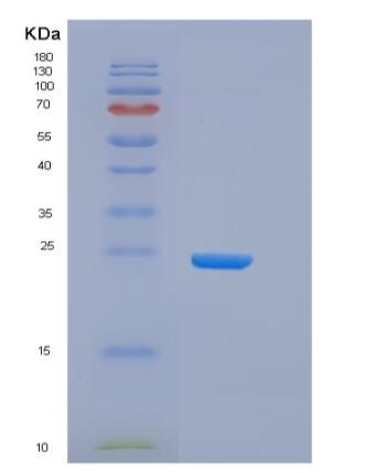 Recombinant Human CD32B Protein (His &AVI Tag), Biotinylated