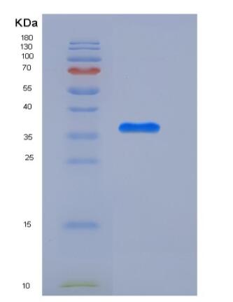 Recombinant Human APEX1 / AP / APEx / Ref-1 Protein (His tag)