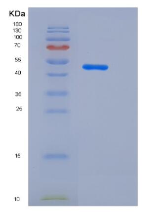 Recombinant Human HDAC4 Protein (aa 612-1084)