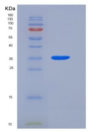 Recombinant Human LRG1 Protein (His tag)