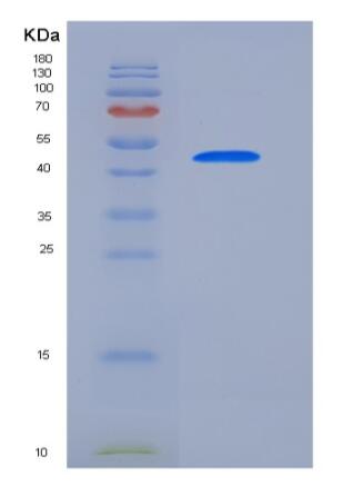 Recombinant Human CCNE1 / Cyclin-E1 Protein