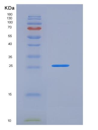 Recombinant Mouse FLRG / Fstl3 Protein (His tag)