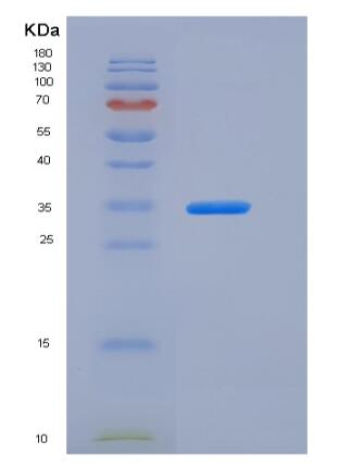 Recombinant Human Carbonic Anhydrase VB / CA5B Protein (His tag)