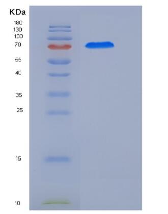 Recombinant Human CCNE1 / Cyclin-E1 Protein (His & GST tag)
