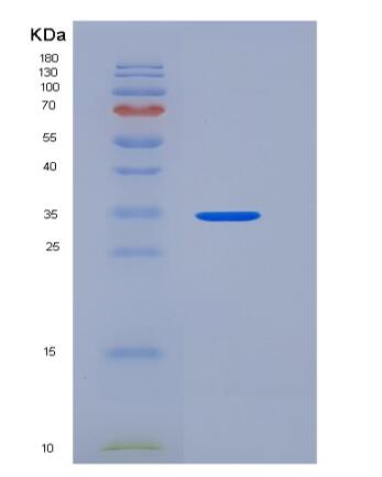 Recombinant Human IL-8 / CXCL8 Protein (aa 28-99, Fc tag)