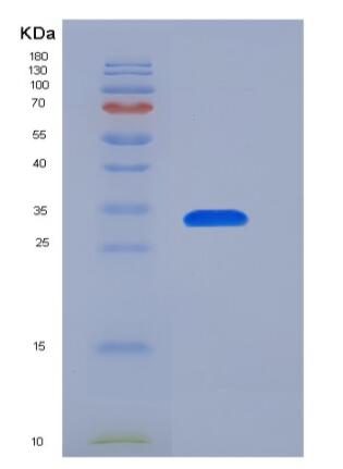 Recombinant Human IL-8 / CXCL8 Protein (aa 23-99, Fc tag)