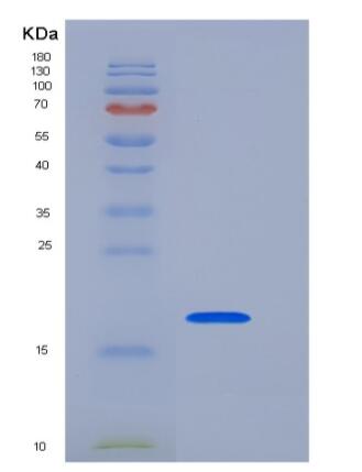 Recombinant Human CD153 / CD30L / TNFSF8 Protein
