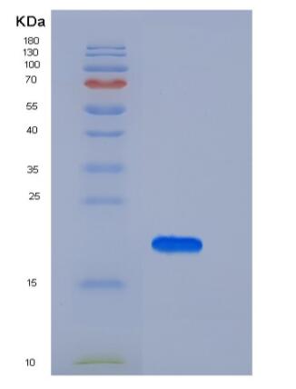 Recombinant Human IL10 / Interleukin-10 Protein