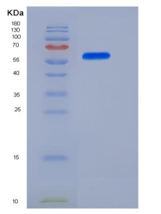 Recombinant Human IL-12 (IL12A &IL12B Heterodimer) Protein (His Tag)