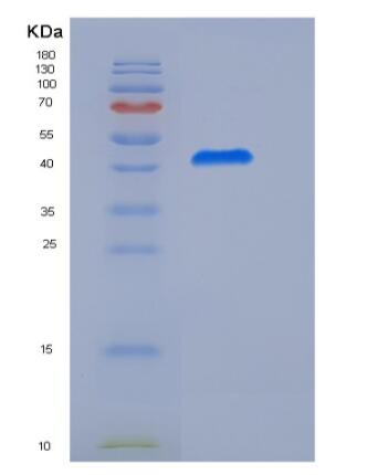 Recombinant Human Vaspin / SerpinA12 Protein (His tag)