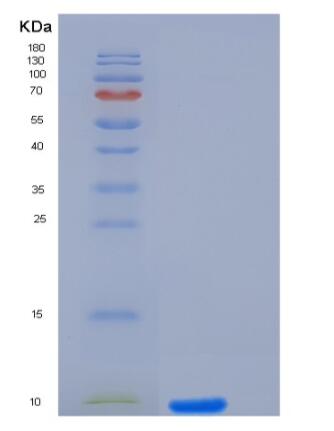 Recombinant Human IL-8 / CXCL8 Protein (aa 23-99)