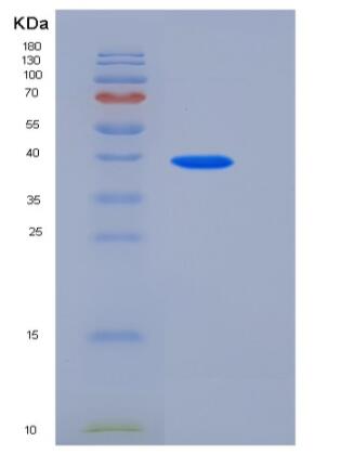 Recombinant Human TETHERIN / BST2 / CD317 Protein (Fc tag)