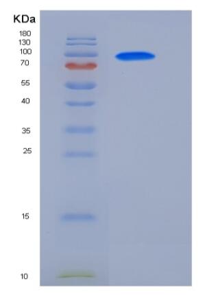 Recombinant Human GAD65 / GAD2 / GAD-2 Protein (GST Tag)