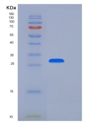 Recombinant Human CD33 / Siglec-3 Protein (His tag)