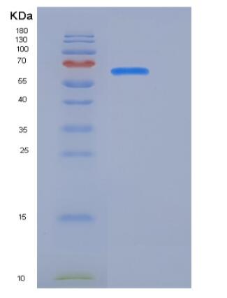 Recombinant Human CDCP1 / CD318 Protein (Fc tag)