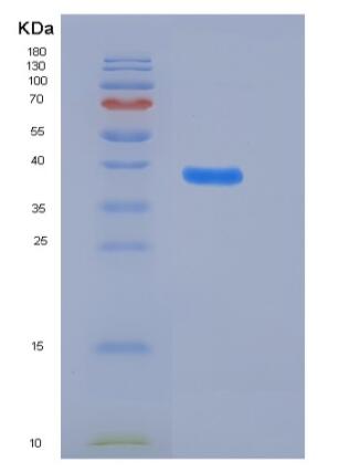 Recombinant Human ADM / Adrenomedullin Protein (Fc tag)