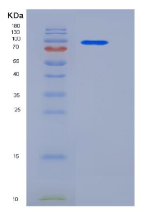 Recombinant Human Neuropilin-1 / NRP1 Protein (Fc tag)