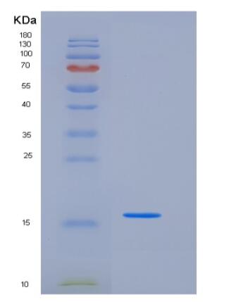 Recombinant Mouse FABP4 / ALBP / A-FABP Protein (His & MYC Tag)