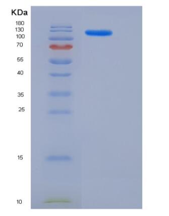 Recombinant Human ACLY / acly / ATP citrate lyase Protein (His tag)