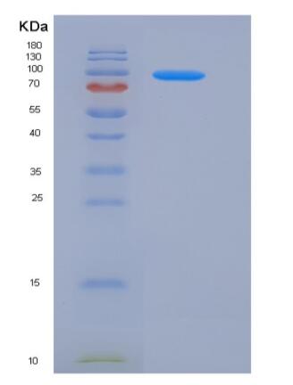 Recombinant Human Thyroid peroxidase / TPO Protein (257 Ser/Ala, 725 Pro/Thr, His tag)