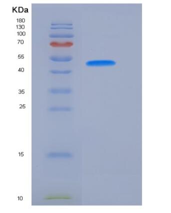 Recombinant Human VNN2 Protein (His Tag)