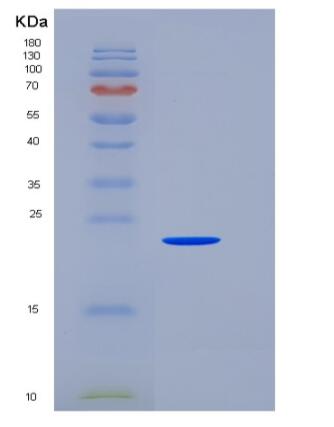 Recombinant Human SNAP25 / SUP Protein (His tag)