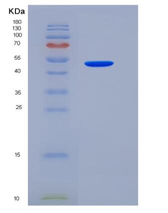 Recombinant Human VNN1 / Vanin-1 Protein (His tag)